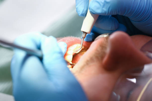 Best Emergency Broken Tooth Repair in Point Baker, FL
