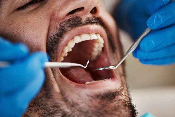 Best Emergency Broken Tooth Repair in Point Baker, FL